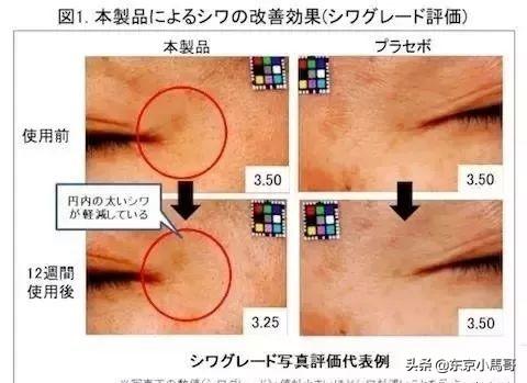 日本公认3大祛皱王解析,POLA、怡丽丝尔、悦薇去皱到底哪家强?
