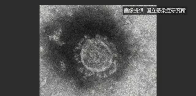 日本电视台采访出现震撼一幕,节目中断后,中国的反应太暖心了