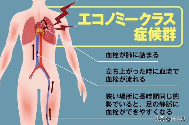 日本式方舱将长什么样子?成田机场隔离区是范例。